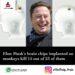 Exclusive: Elon Musk’s Brain Chip Experimented On Monkeys Kill 15 Out Of 23